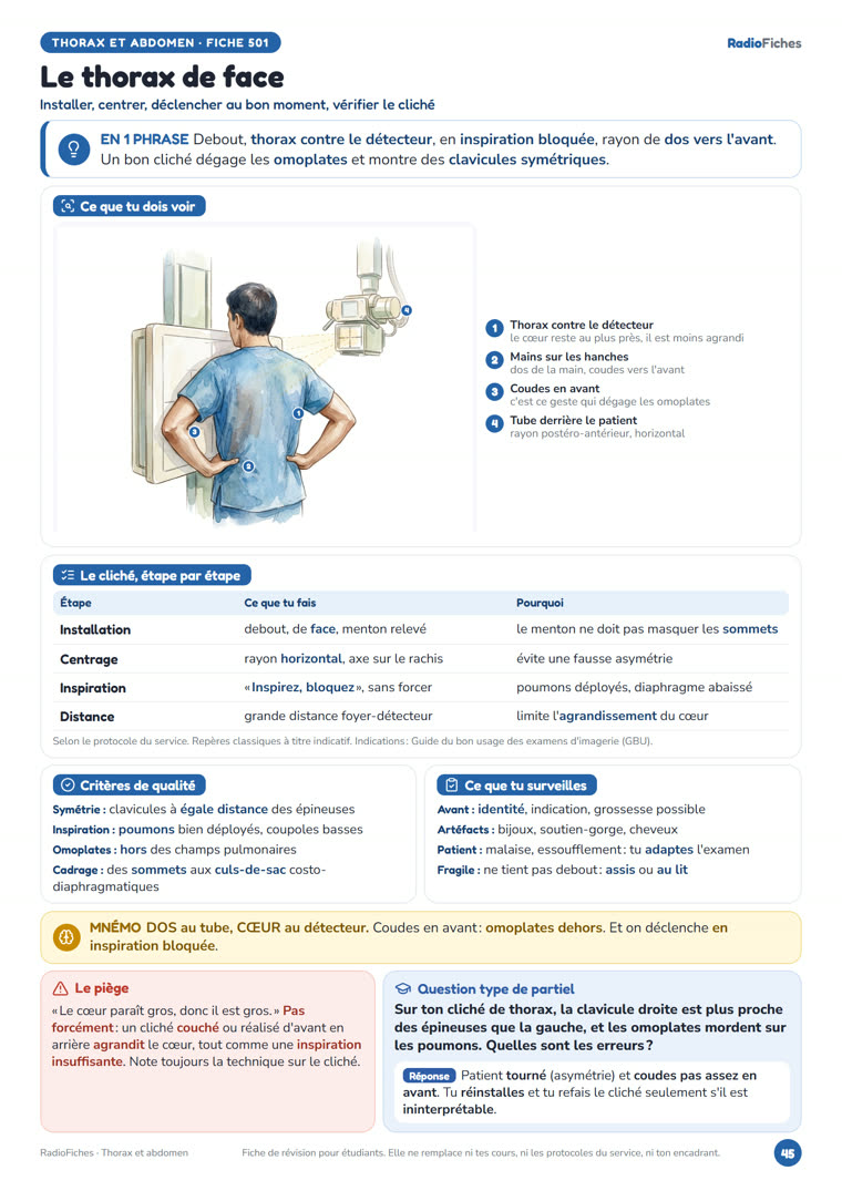 Fiche « Le thorax de face » de RadioFiches